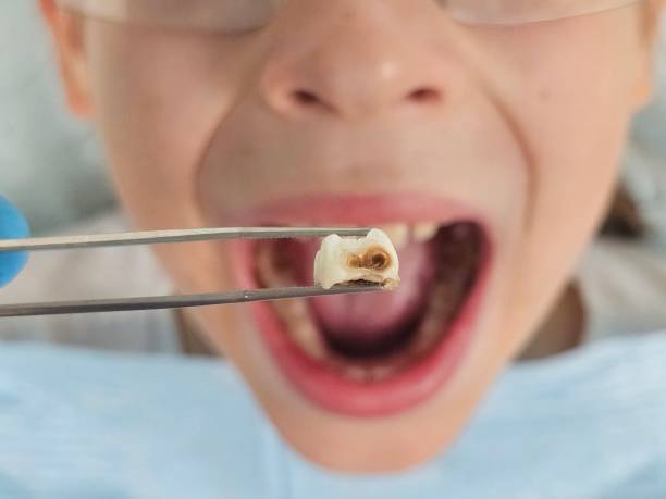Best Broken Tooth Emergency  in Edmundson, MO